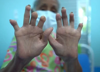 menos-atencao-e-recursos:-doencas-negligenciadas-seguem-como-desafio