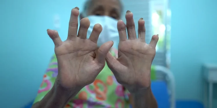 menos-atencao-e-recursos:-doencas-negligenciadas-seguem-como-desafio